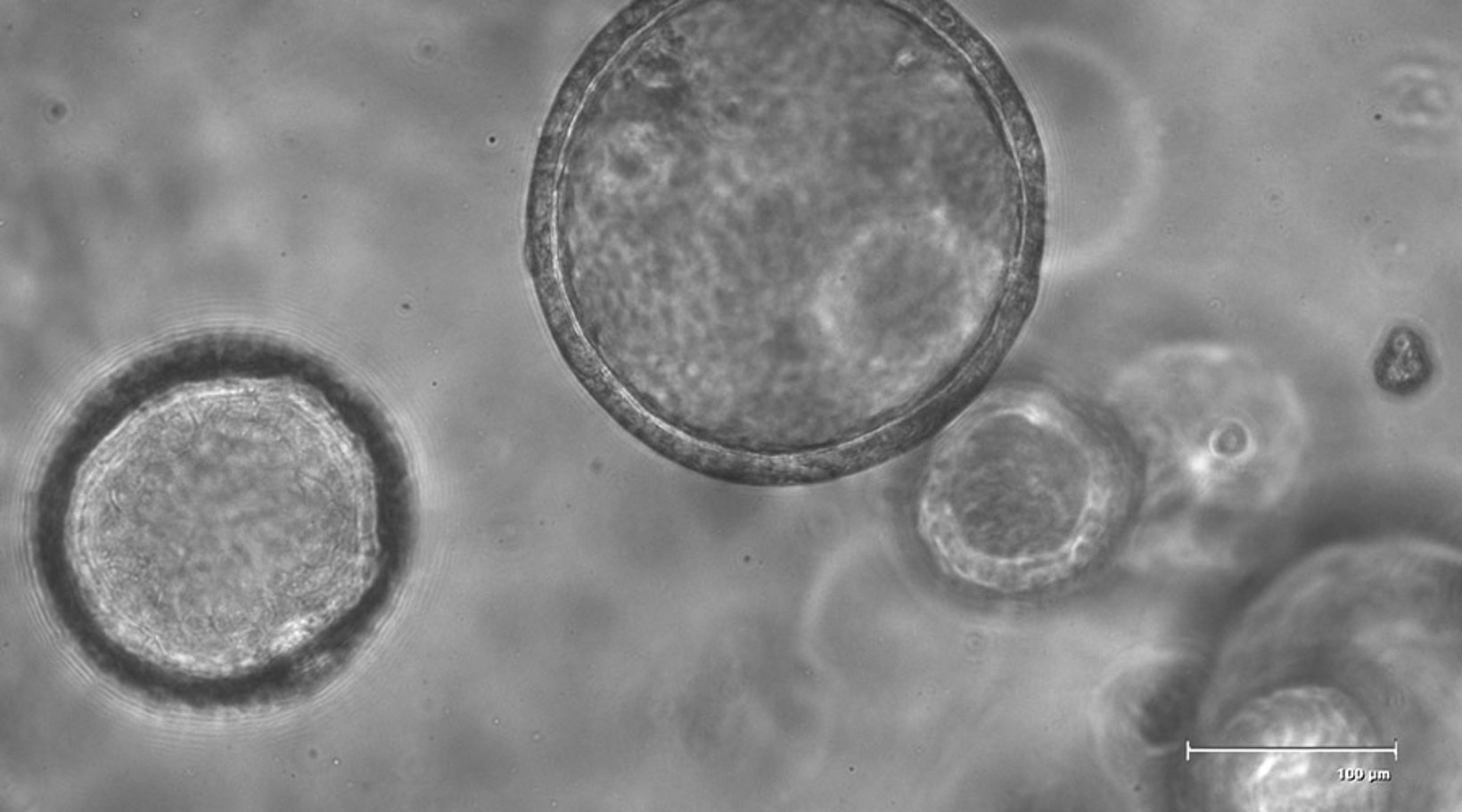 Lungenorganoide unter dem Mikroskop