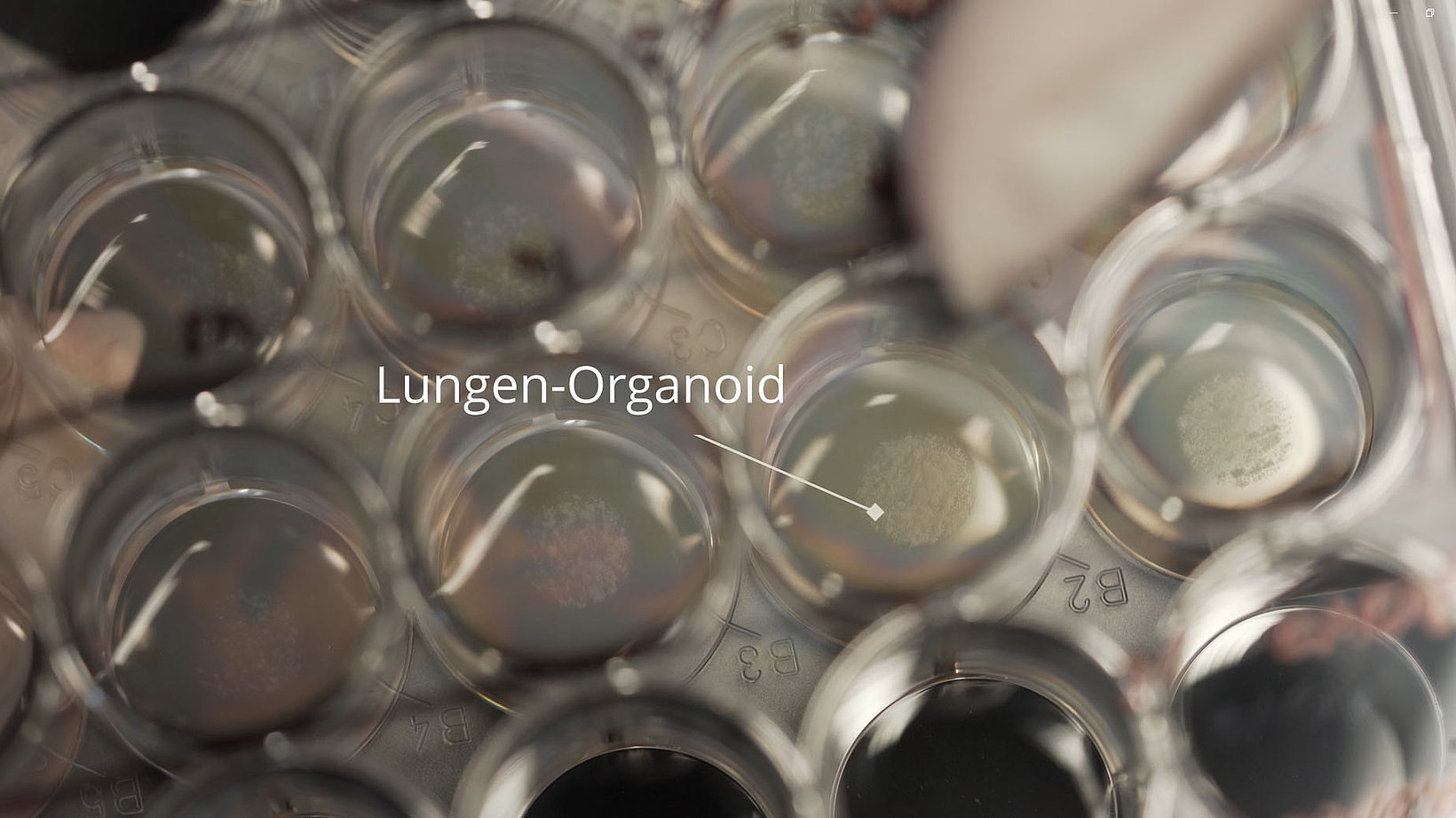 Lungenorganoide in sogenannter Multi-Well-Zellkulturplatte
